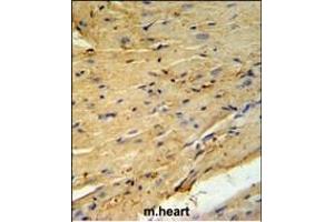 PLB-T17 Antibody (ABIN653840 and ABIN2843104) IHC analysis in formalin fixed and paraffin embedded mouse heart tissue followed by peroxidase conjugation of the secondary antibody and DAB staining. (PLB-T17 (AA 1-30) 抗体)