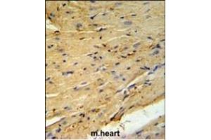 PLB-T17 Antibody (ABIN653840 and ABIN2843104) IHC analysis in formalin fixed and paraffin embedded mouse heart tissue followed by peroxidase conjugation of the secondary antibody and DAB staining. (PLB-T17 (AA 1-30) 抗体)