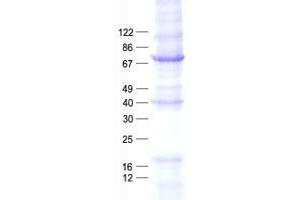 Validation with Western Blot (NR4A3 Protein (His tag))