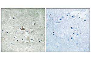 Immunohistochemistry (IHC) image for anti-Neurotrophic Tyrosine Kinase, Receptor, Type 2 (NTRK2) (pTyr706), (pTyr707) antibody (ABIN1847661) (TRKB 抗体  (pTyr706, pTyr707))