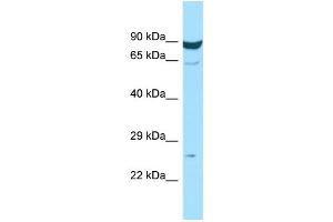 WB Suggested Anti-MS4A7 Antibody Titration: 1. (MS4A7 抗体  (Middle Region))