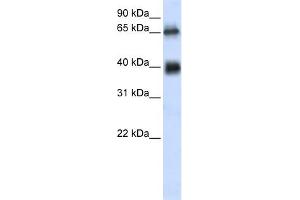 WB Suggested Anti-C6orf113 Antibody Titration:  0. (ZUFSP 抗体  (Middle Region))