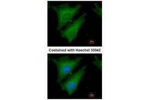 ICC/IF Image Immunofluorescence analysis of paraformaldehyde-fixed HeLa, using SOCS4, antibody at 1:200 dilution. (SOCS4 抗体  (C-Term))