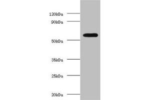 Western blot All lanes: OXCT1 antibody at 2 μg/mL + Hela whole cell lysate Secondary Goat polyclonal to rabbit IgG at 1/15000 dilution Predicted band size: 57, 14 kDa Observed band size: 57 kDa (OXCT1 抗体  (AA 40-520))