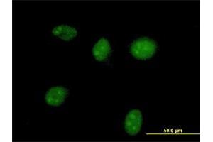 Immunofluorescence of purified MaxPab antibody to HGD on HeLa cell. (HGD 抗体  (AA 1-445))