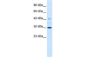 Western Blotting (WB) image for anti-Voltage-Dependent Anion Channel 1 (VDAC1) (C-Term) antibody (ABIN2776153)