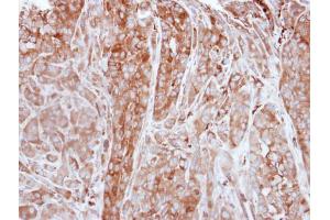IHC-P Image Immunohistochemical analysis of paraffin-embedded A549 xenograft, using FTL, antibody at 1:500 dilution. (FTL 抗体)
