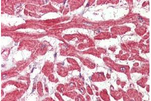 Heart, Human: Formalin-Fixed, Paraffin-Embedded (FFPE) (FABP7 抗体  (AA 101-111))