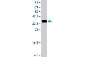 Western Blotting (WB) image for anti-ATPase Type 13A2 (ATP13A2) (AA 68-154) antibody (ABIN565066)