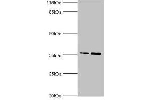 Western blot All lanes: CFHR2 antibody at 2 μg/mL Lane 1: Hela whole cell lysate Lane 2: 293T whole cell lysate Secondary Goat polyclonal to rabbit IgG at 1/10000 dilution Predicted band size: 31, 28 kDa Observed band size: 36 kDa (CFHR2 抗体  (AA 20-269))