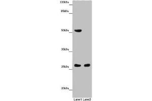 Western blot All lanes: CHTOP antibody at 14 μg/mL Lane 1: Mouse heart tissue Lane 2: Mouse kidney tissue Secondary Goat polyclonal to rabbit IgG at 1/10000 dilution Predicted band size: 27, 22 kDa Observed band size: 27, 52 kDa (CHTOP 抗体  (AA 179-248))