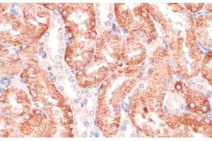 Immunohistochemistry of paraffin-embedded Rat kidney using RPIA Polyclonal Antibody at dilution of 1:100 (40x lens). (Ribose 5-Phosphate Isomerase A (RPIA) 抗体)