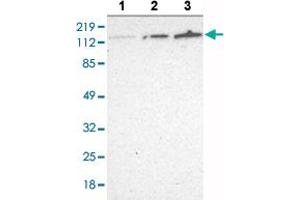 Western blot analysis of Lane 1: RT-4 cell lysate, Lane 2: U-251 MG sp cell lysate, Lane 3: A-431 cell lysate with WDHD1 polyclonal antibody at 1:250 - 1:500 dilution. (WDHD1 抗体  (AA 231-345))