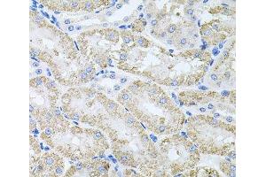 Immunohistochemistry of paraffin-embedded Mouse kidney using TARS Polyclonal Antibody at dilution of 1:100 (40x lens). (TARS 抗体)