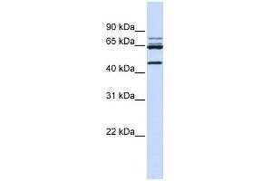 DDX47 antibody used at 1 ug/ml to detect target protein. (DDX47 抗体)