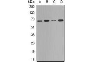 Western blot analysis of Deltex-2 expression in Jurkat (A), HepG2 (B), mouse testis (C), mouse spleen (D) whole cell lysates. (DTX2 抗体)