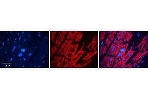 Rabbit Anti-DHCR24 Antibody   Formalin Fixed Paraffin Embedded Tissue: Human heart Tissue Observed Staining: Cytoplasmic Primary Antibody Concentration: 1:100 Other Working Concentrations: 1:600 Secondary Antibody: Donkey anti-Rabbit-Cy3 Secondary Antibody Concentration: 1:200 Magnification: 20X Exposure Time: 0. (Seladin 1 抗体  (Middle Region))