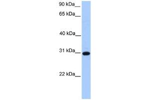WB Suggested Anti-ETFB Antibody Titration: 0. (ETFB 抗体  (C-Term))