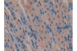 Immunohistochemistry (IHC) image for anti-Sclerostin Domain Containing 1 (SOSTDC1) (AA 24-206) antibody (ABIN7439462)