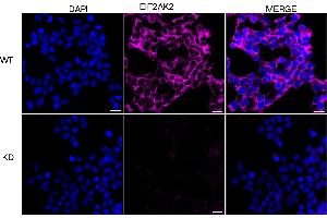 Immunocytochemical staining of HeLa cells using EIF2AK2 antibody (ABIN7798506), 1:1,000), Top panel: wild-type (WT), Bottom panal: EIF2AK2 shRNA knockdown (KD). (EIF2AK2 抗体)