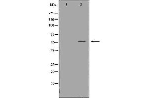 Western blot analysis of Hela whole cell lysates, using TRAF2  Antibody. (TRAF2 抗体  (C-Term))