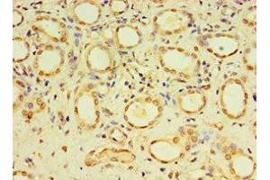 Immunohistochemistry of paraffin-embedded human kidney tissue using ABIN7149492 at dilution of 1:100 (DACT3 抗体  (AA 1-160))