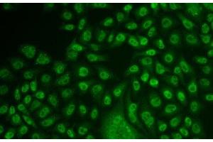 Immunofluorescence analysis of U2OS cells using TFPT Polyclonal Antibody (TFPT 抗体)