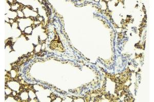 ABIN6276798 at 1/100 staining Mouse lung tissue by IHC-P. (PDE4D 抗体  (C-Term))