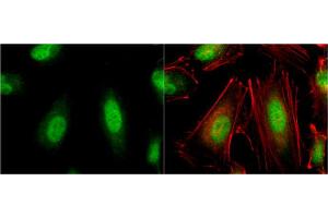 Immunofluorescence (IF) image for anti-Von Hippel-Lindau Tumor Suppressor, E3 Ubiquitin Protein Ligase (VHL) antibody (ABIN2854928)