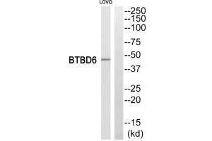 Western blot analysis of extracts from LOVO cells, using BTBD6 antiobdy. (BTBD6 抗体)