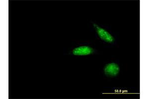 Immunofluorescence of purified MaxPab antibody to ZNF447 on HeLa cell. (ZSCAN18 抗体  (AA 1-510))