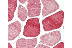 Formalin-fixed and paraffin-embedded H.