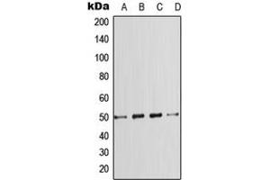 Western blot analysis of SMAD7 expression in HeLa (A), A431 (B), SP2/0 (C), PC12 (D) whole cell lysates. (SMAD7 抗体  (Center))