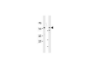 HCDC7L1 Antibody (M9) (ABIN1882165 and ABIN2841618) western blot analysis in HT29,MCF-7 cell line lysates (35 μg/lane). (CDC7 抗体  (N-Term))