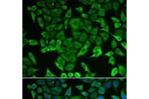 Immunofluorescence analysis of MCF-7 cells using RARS Polyclonal Antibody (RARS 抗体)