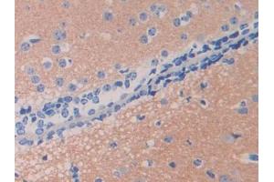 DAB staining on IHC-P; Samples: Mouse Cerebrum Tissue (UCHL5 抗体  (AA 66-268))