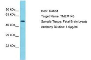 Image no. 1 for anti-Transmembrane Protein 143 (TMEM143) (AA 39-88) antibody (ABIN6750625) (TMEM143 抗体  (AA 39-88))