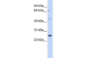 WB Suggested Anti-SPATA22 Antibody Titration: 0. (SPATA22 抗体  (N-Term))