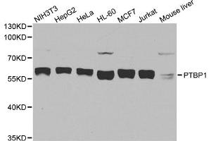 Western blot analysis of extracts of various cell lines, using PTBP1 antibody. (PTBP1 抗体)