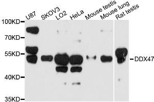 Western blot analysis of extracts of various cell lines, using DDX47 antibody. (DDX47 抗体)