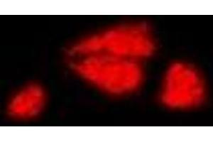 Immunofluorescent analysis of DAX1 staining in MCF7 cells. (NR0B1 抗体)