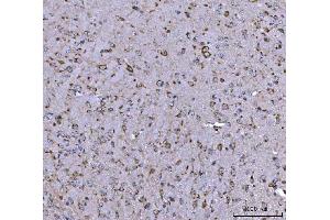 IHC analysis of BBS9 using anti-BBS9 antibody (ABIN7601518). (BBS9 抗体  (AA 37-793))