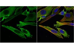 ICC/IF Image Stathmin 1 antibody detects Stathmin 1 protein at cytoplasm by immunofluorescent analysis. (Stathmin 1 抗体  (C-Term))