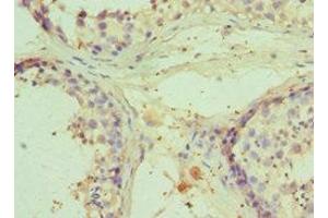 Immunohistochemistry of paraffin-embedded human testis tissue using ABIN7151208 at dilution of 1:100 (RNF8 抗体  (AA 1-260))