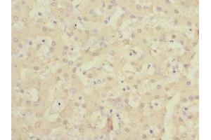 Immunohistochemistry of paraffin-embedded human liver tissue using ABIN7147123 at dilution of 1:100 (CD166 抗体  (AA 28-180))