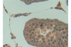 Immunohistochemistry (IHC) image for anti-Surfactant Protein A1 (SFTPA1) (AA 21-248) antibody (ABIN7432871)