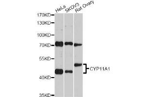 Western blot analysis of extracts of various cell lines, using CYP11A1 Antibody (ABIN5970856) at 1/2000 dilution. (CYP11A1 抗体)