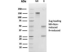 SDS-PAGE Analysis Purified Peroxiredoxin 4 Monoclonal Antibody (CPTC-PRDX4-2). (Peroxiredoxin 4 抗体)