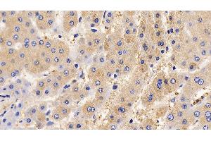 Immunohistochemistry (IHC) image for anti-Interleukin 13 Receptor, alpha 2 (IL13RA2) (AA 238-334) antibody (ABIN7437515)