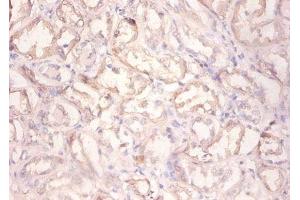Immunohistochemistry of paraffin-embedded human kidney tissue using ABIN7154210 at dilution of 1:100 (PYGL 抗体  (AA 2-846))
